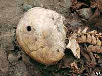 Skull from Lima with gunshot entry